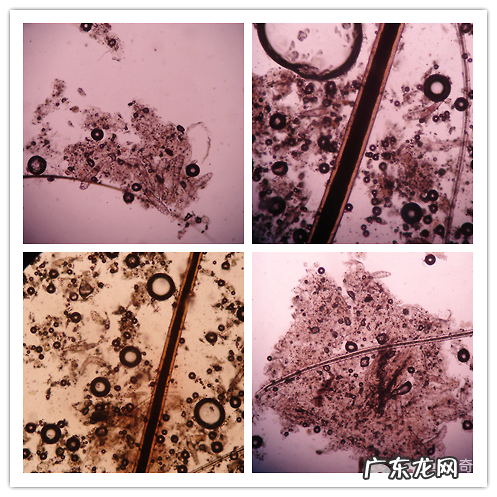 一例藏獒犬蠕形螨的病例分析