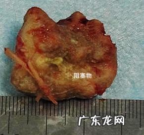 犬食道梗阻病例分析