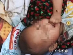 妇联回应女婴住垃圾堆脸上苍蝇乱飞