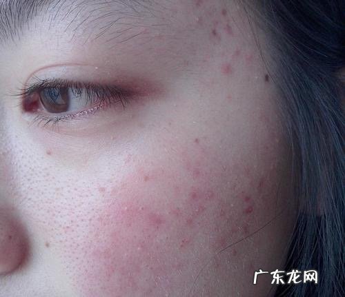 理肤泉和雅漾哪个好用?理肤泉和雅漾喷雾哪个好一点?