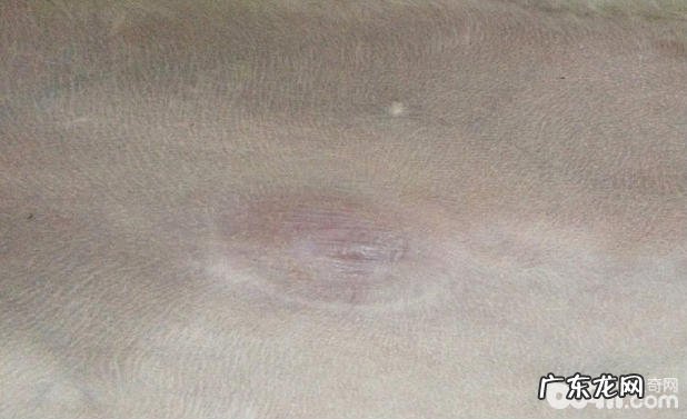 犬脐疝的确诊及手术方法