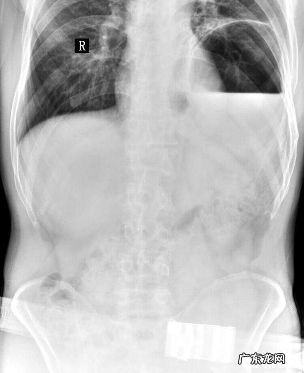 犬膈疝的确诊与医治