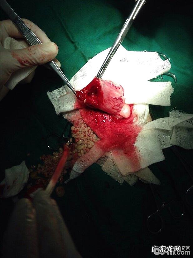 犬尿路结石的确诊