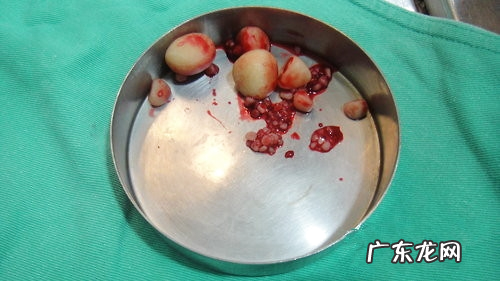 犬尿路结石的确诊