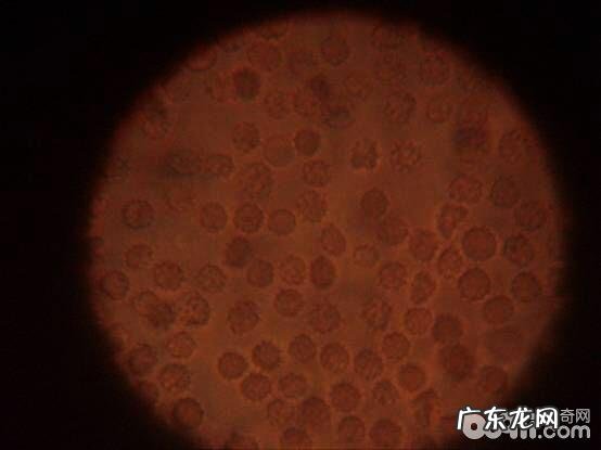 犬附红体病的确诊与医治