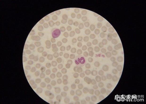 犬附红体病的确诊与医治