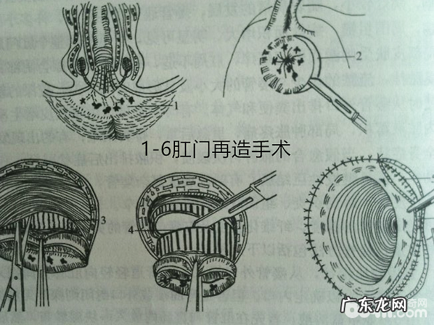 犬的肛门周围病症
