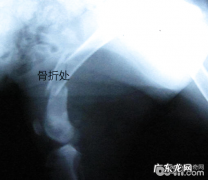 犬的肱骨骨折及其内固定不动