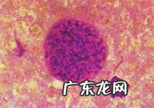 养宠物家中如何预防弓形虫病