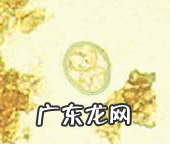 养宠物家中如何预防弓形虫病