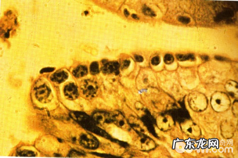 养宠物家中如何预防弓形虫病