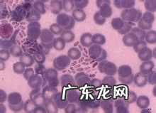 养宠物家中如何预防弓形虫病