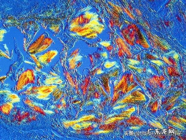 为什么,寒露节气过后,要重视养护肾脏,具体怎么做?