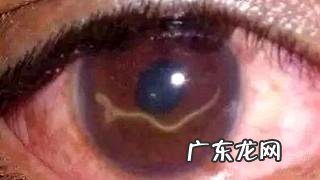 眼线虫会传染人吗?太可怕了!