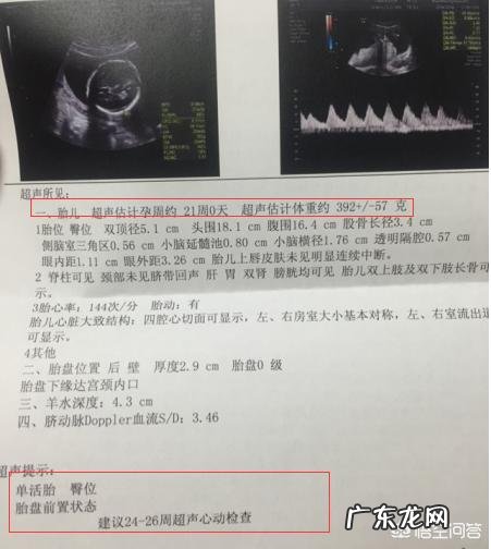 怀孕八个月,彩超医生说孩子腿长,这是什么意思?