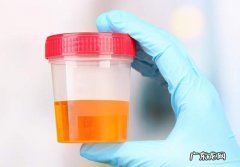 原来小狗的“尿里”色调，隐藏了这么多专业技能！