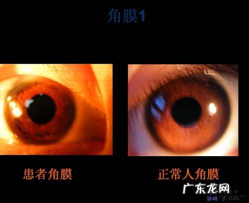 拍眼睛照片配文 拍眼睛照片