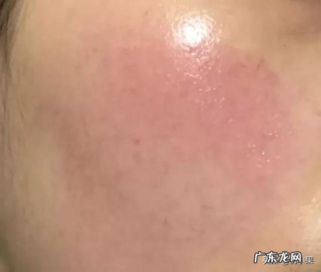 为什么一些人不用护肤品皮肤也会很好?