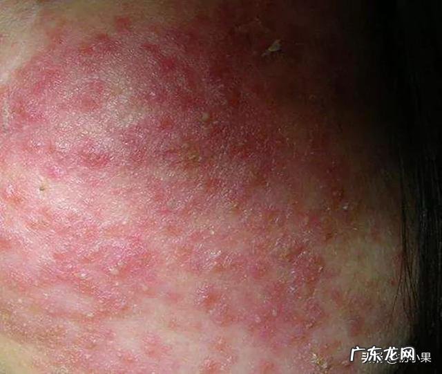 为什么一些人不用护肤品皮肤也会很好?