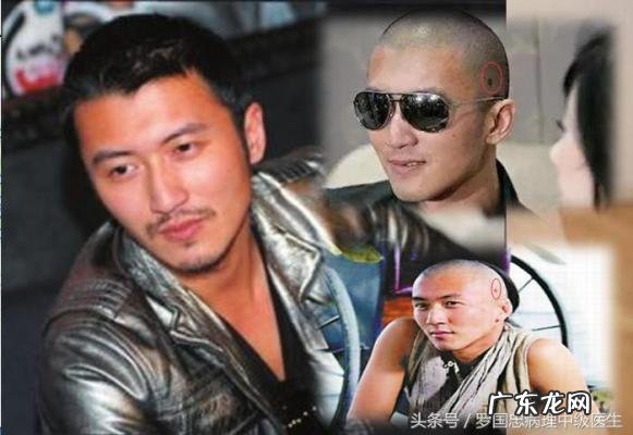 谢霆锋患皮肤癌曝真情 谢霆锋患皮肤癌