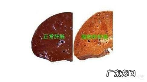 瘦身跟肝脏调理有什么联系吗