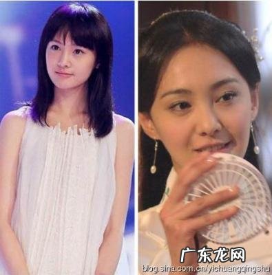 郑爽整容后 又整回去了吗 郑爽整容后