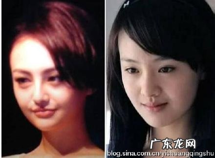 郑爽整容后 又整回去了吗 郑爽整容后