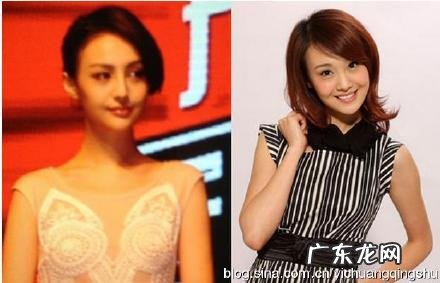 郑爽整容后 又整回去了吗 郑爽整容后