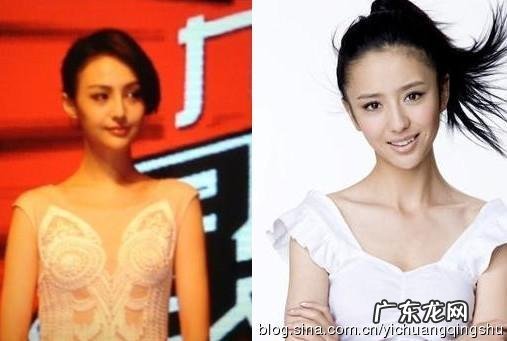 郑爽整容后 又整回去了吗 郑爽整容后