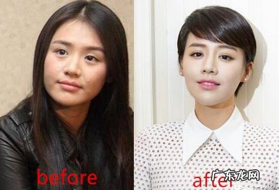 马思纯周冬雨 马思纯整容