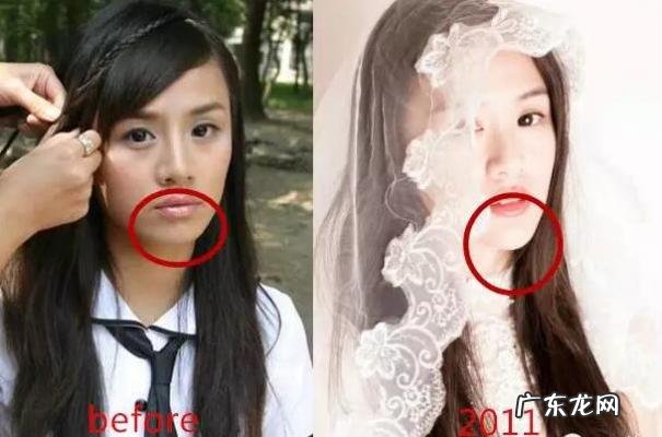 马思纯周冬雨 马思纯整容