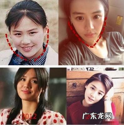 马思纯周冬雨 马思纯整容