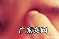 撕手皮、抠痘痂,如何拯救强迫性皮肤剥离症?