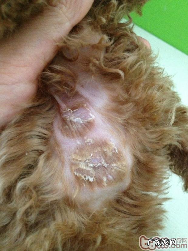 常见的皮肤病查验方式