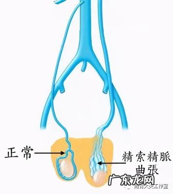 男人会无缘无故硬起来吗 让男人硬起来的图片