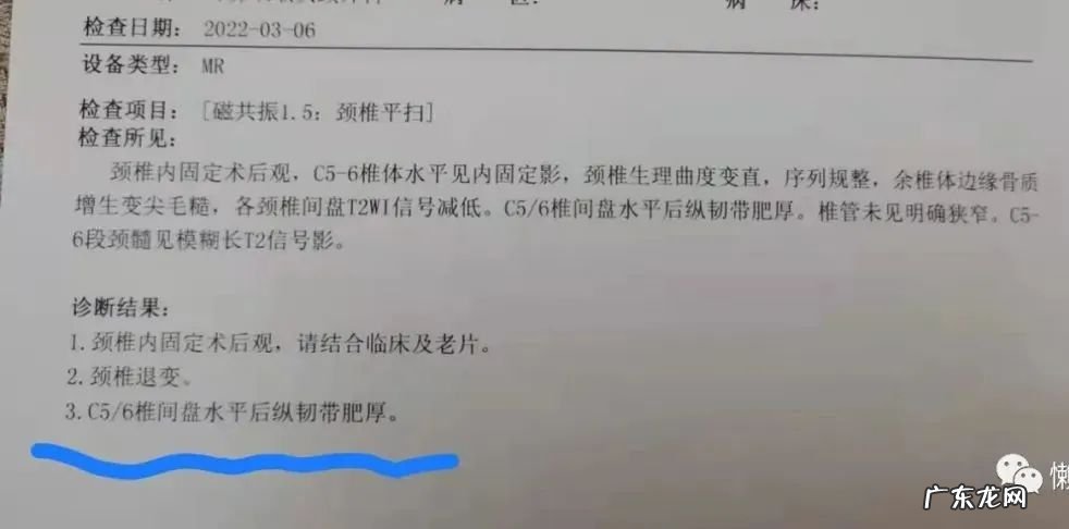 引起头痛头晕的病因及中药治疗方