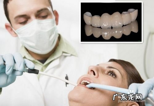 烤瓷牙能用多久