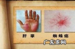 血痣和红痣的区别图片 流血 血痣和红痣的区别图片