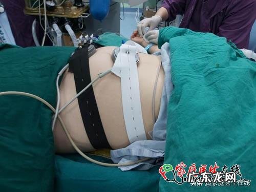 准备怀孕生小孩？孕前体检，先查查你的“脑子”有没有问题