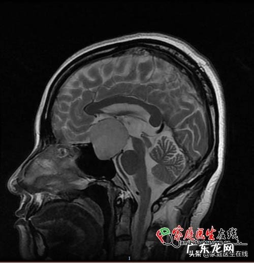 准备怀孕生小孩？孕前体检，先查查你的“脑子”有没有问题