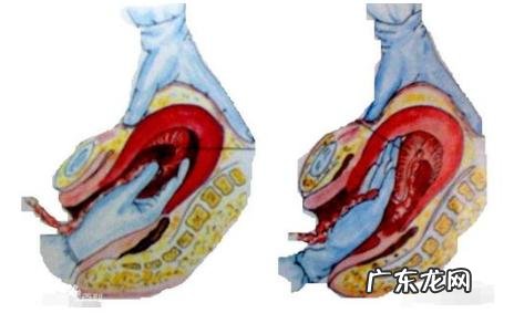 顺产分娩的三个产程-在家生孩子顺产全产程
