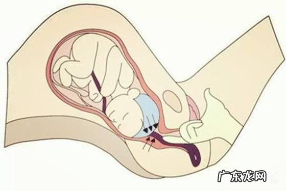 顺产分娩的三个产程-在家生孩子顺产全产程