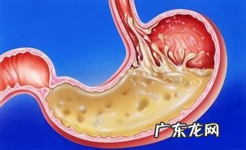 胃酸最快的治疗方法,吃什么菜不反酸对胃好？