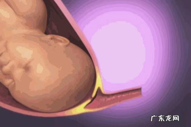 孕妇临产时如何准备-孕妇临产准备物品