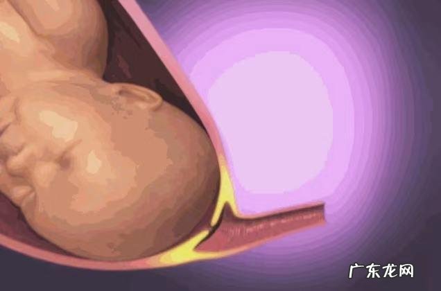 孕妇临产时如何准备-孕妇临产准备物品