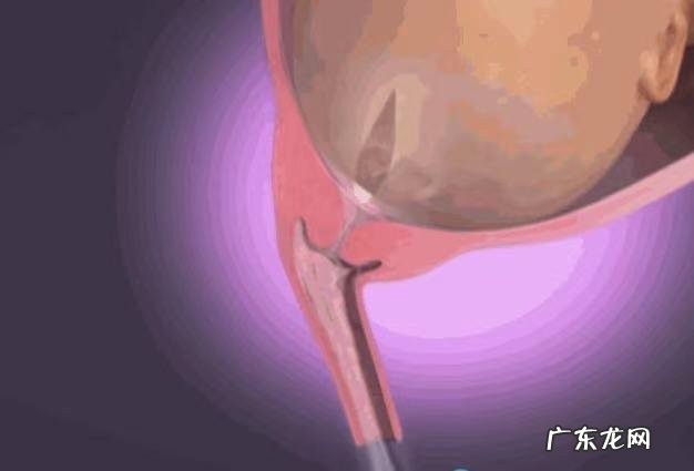 孕妇临产时如何准备-孕妇临产准备物品