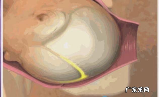 孕妇临产时如何准备-孕妇临产准备物品