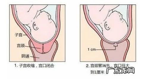 初产母猪产道狭窄怎么也出不来-母猪产仔不进入产道