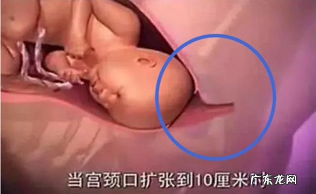 初产母猪产道狭窄怎么也出不来-母猪产仔不进入产道