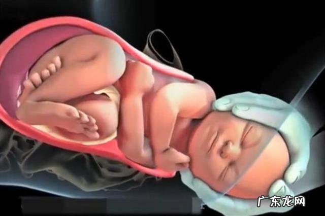 顺产分娩的全部步骤-自然顺产分娩